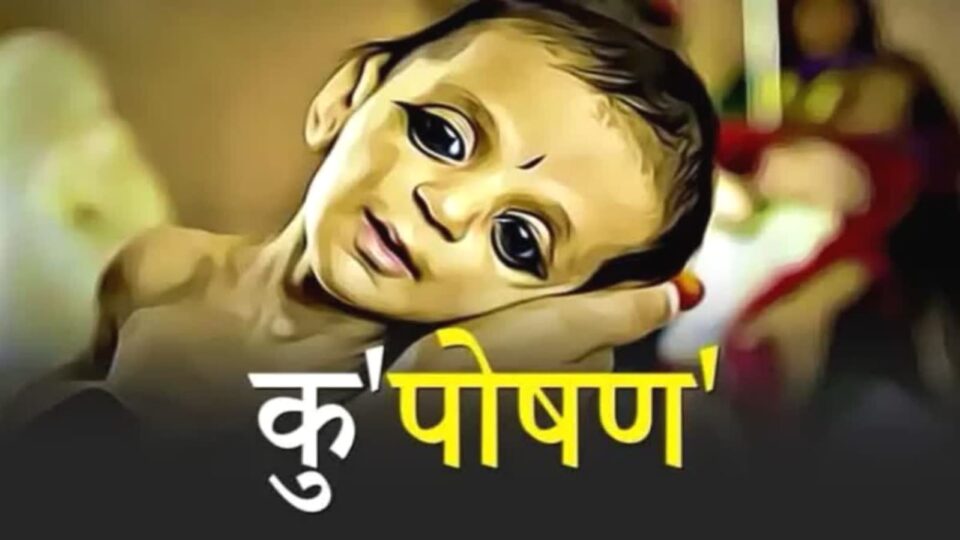 बांदा में कुपोषण की बहार : नहीं कम हो रहा कुपोषण का आंकडा़