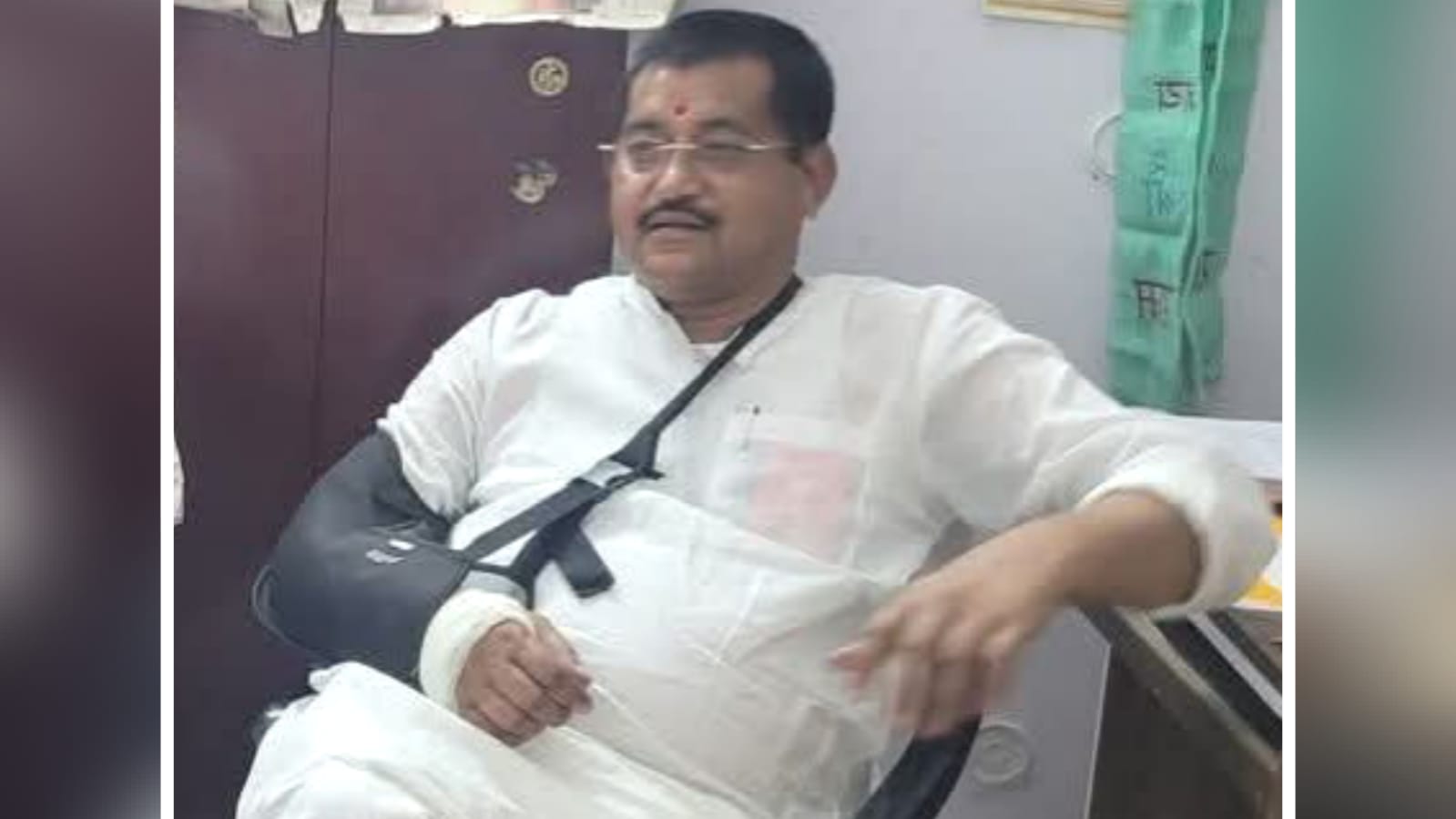 मंत्री रामकेश दर्द सहते रहे, जनता से छुपाया, लेकिन एक्सरे ने खोला राज