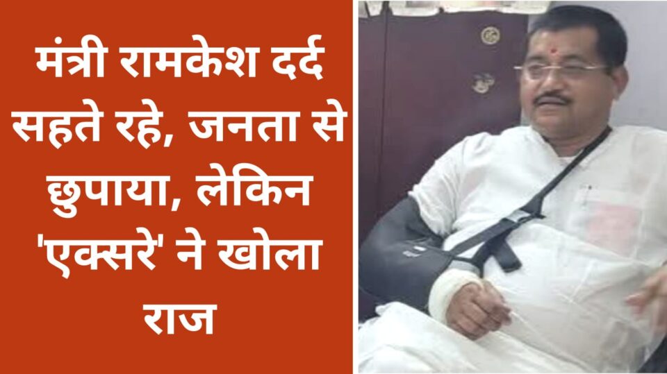मंत्री रामकेश दर्द सहते रहे, जनता से छुपाया, लेकिन एक्सरे ने खोला राज