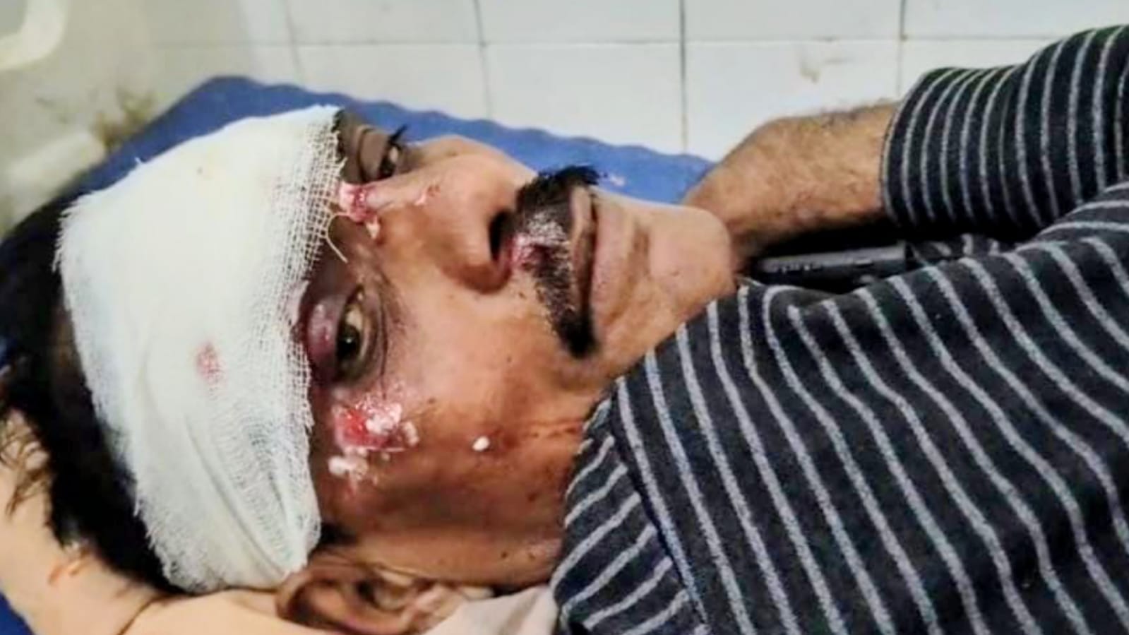 पत्रकार इकबाल खान को कुचलने की कोशिश ? कंधा टूटा सिर फटा, पुलिस जांच में जुटी